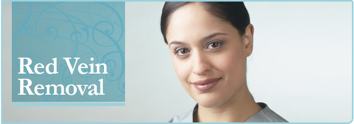 Red Vein Removal